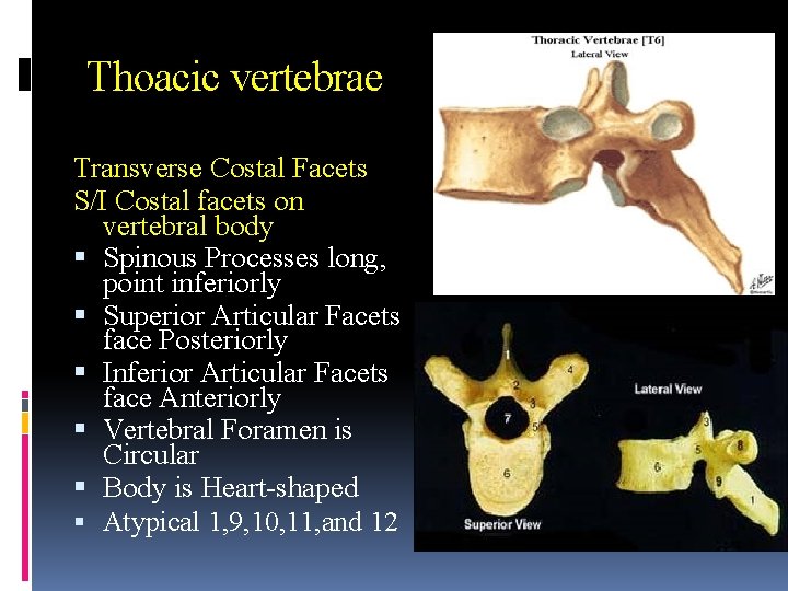 Thoacic vertebrae Transverse Costal Facets S/I Costal facets on vertebral body Spinous Processes long,