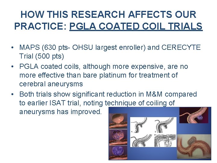 HOW THIS RESEARCH AFFECTS OUR PRACTICE: PGLA COATED COIL TRIALS • MAPS (630 pts- HOW THIS RESEARCH AFFECTS OUR PRACTICE: PGLA COATED COIL TRIALS • MAPS (630 pts-