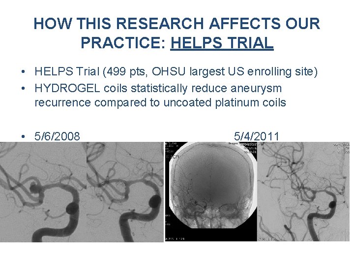 HOW THIS RESEARCH AFFECTS OUR PRACTICE: HELPS TRIAL • HELPS Trial (499 pts, OHSU HOW THIS RESEARCH AFFECTS OUR PRACTICE: HELPS TRIAL • HELPS Trial (499 pts, OHSU