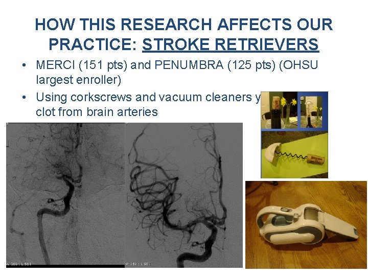 HOW THIS RESEARCH AFFECTS OUR PRACTICE: STROKE RETRIEVERS • MERCI (151 pts) and PENUMBRA HOW THIS RESEARCH AFFECTS OUR PRACTICE: STROKE RETRIEVERS • MERCI (151 pts) and PENUMBRA