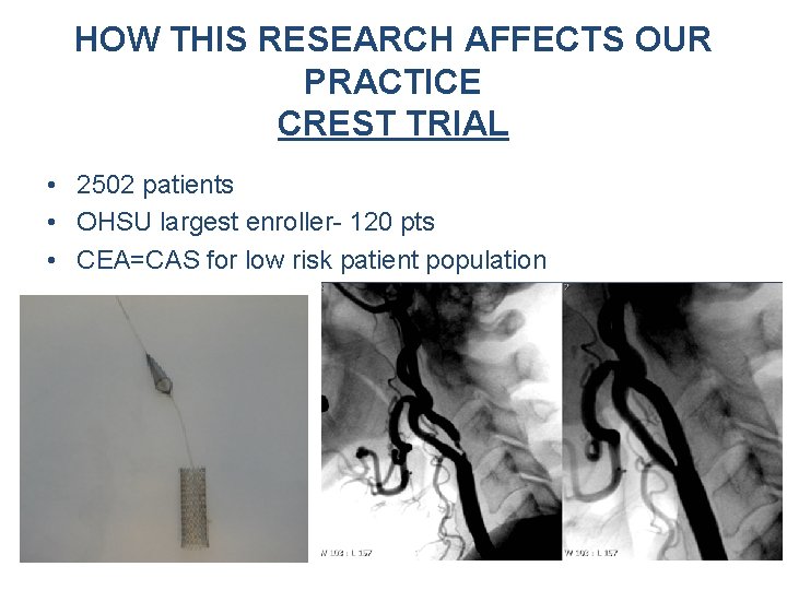 HOW THIS RESEARCH AFFECTS OUR PRACTICE CREST TRIAL • 2502 patients • OHSU largest HOW THIS RESEARCH AFFECTS OUR PRACTICE CREST TRIAL • 2502 patients • OHSU largest