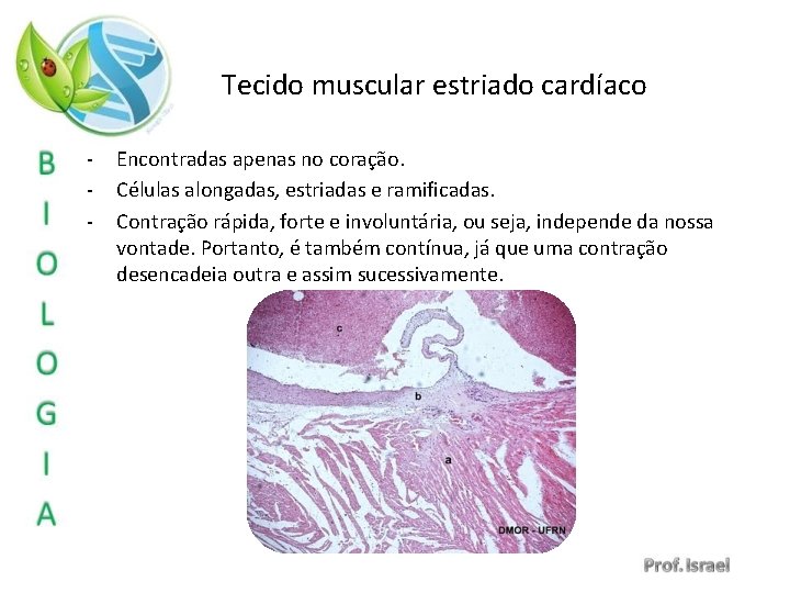 Tecido muscular estriado cardíaco - Encontradas apenas no coração. Células alongadas, estriadas e ramificadas.