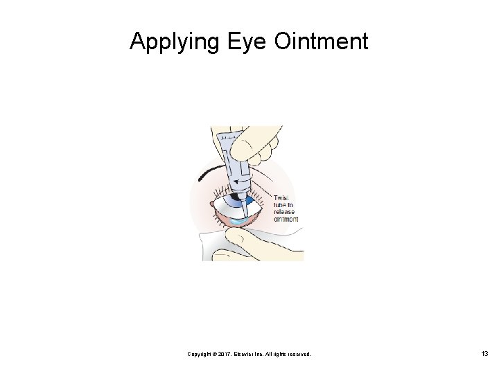 Applying Eye Ointment Copyright © 2017, Elsevier Inc. All rights reserved. 13 