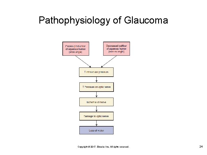 Pathophysiology of Glaucoma Copyright © 2017, Elsevier Inc. All rights reserved. 24 
