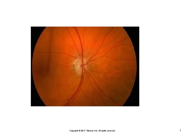 Copyright © 2017, Elsevier Inc. All rights reserved. 1 