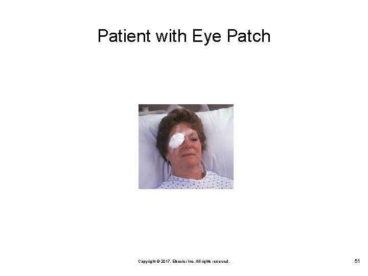 Patient with Eye Patch Copyright © 2017, Elsevier Inc. All rights reserved. 51 