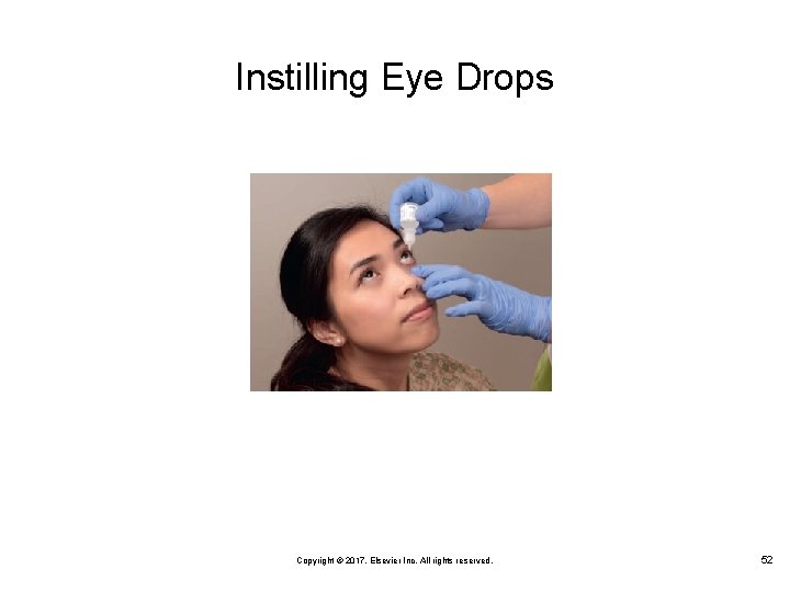 Instilling Eye Drops Copyright © 2017, Elsevier Inc. All rights reserved. 52 