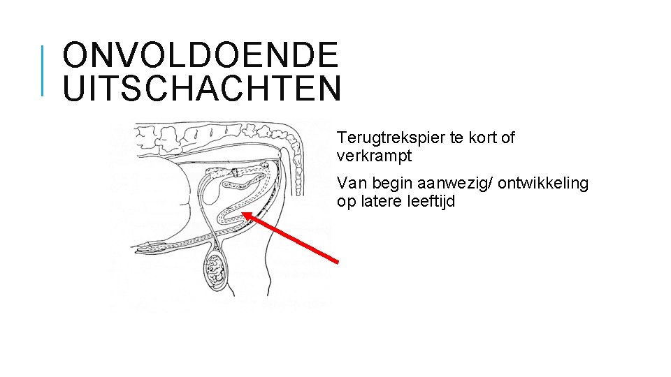 ONVOLDOENDE UITSCHACHTEN Terugtrekspier te kort of verkrampt Van begin aanwezig/ ontwikkeling op latere leeftijd