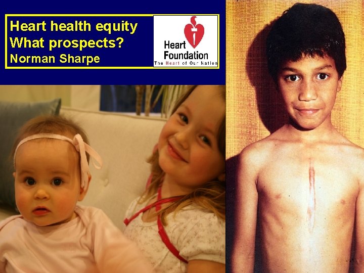 Heart health equity What prospects? Norman Sharpe Heart health equity What prospects? Norman Sharpe