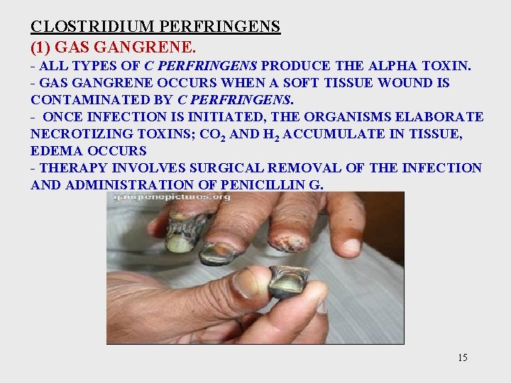 CLOSTRIDIUM PERFRINGENS (1) GAS GANGRENE. - ALL TYPES OF C PERFRINGENS PRODUCE THE ALPHA