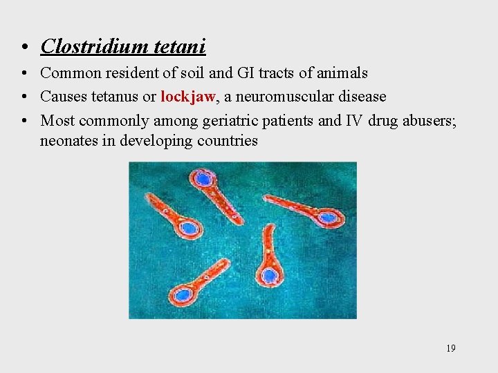  • Clostridium tetani • Common resident of soil and GI tracts of animals