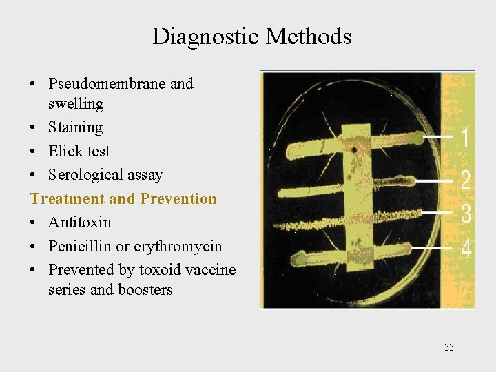 Diagnostic Methods • Pseudomembrane and swelling • Staining • Elick test • Serological assay