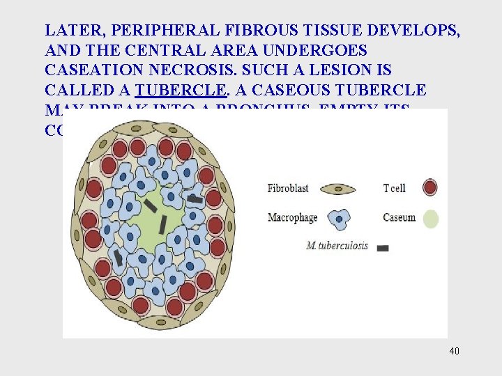 LATER, PERIPHERAL FIBROUS TISSUE DEVELOPS, AND THE CENTRAL AREA UNDERGOES CASEATION NECROSIS. SUCH A