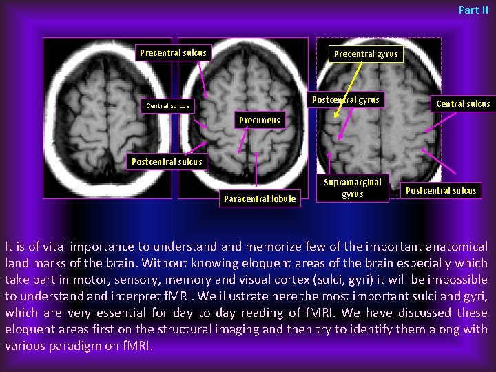 Part II Precentral sulcus Precentral gyrus Postcentral gyrus Central sulcus Precuneus Postcentral sulcus Paracentral