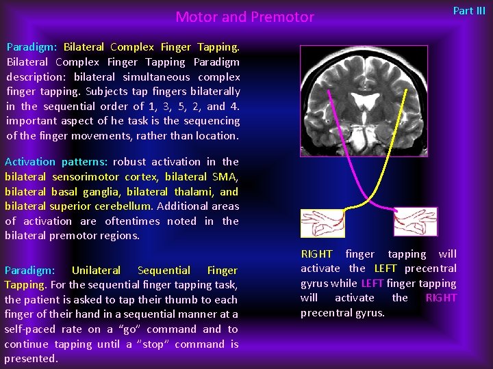 Motor and Premotor Part III Paradigm: Bilateral Complex Finger Tapping Paradigm description: bilateral simultaneous