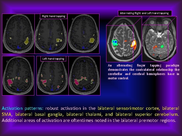 Right hand tapping Alternating Right and Left hand tapping An alternating finger tapping paradigm