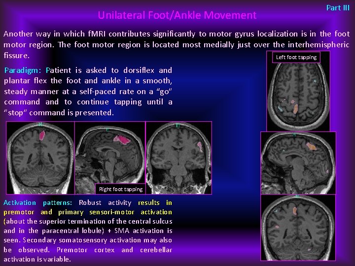 Unilateral Foot/Ankle Movement Part III Another way in which f. MRI contributes significantly to