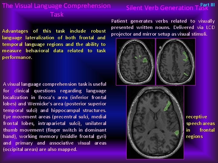 The Visual Language Comprehension Task Advantages of this task include robust language lateralization of