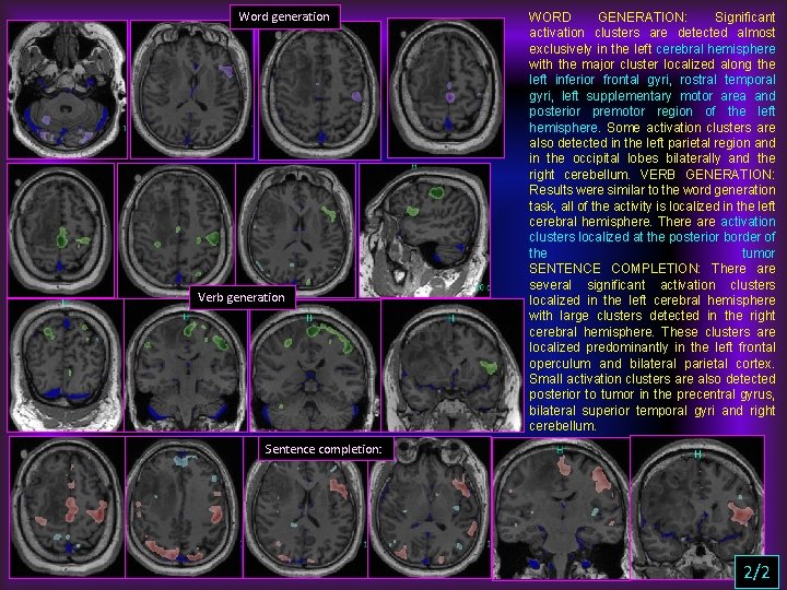 Word generation Verb generation WORD GENERATION: Significant activation clusters are detected almost exclusively in