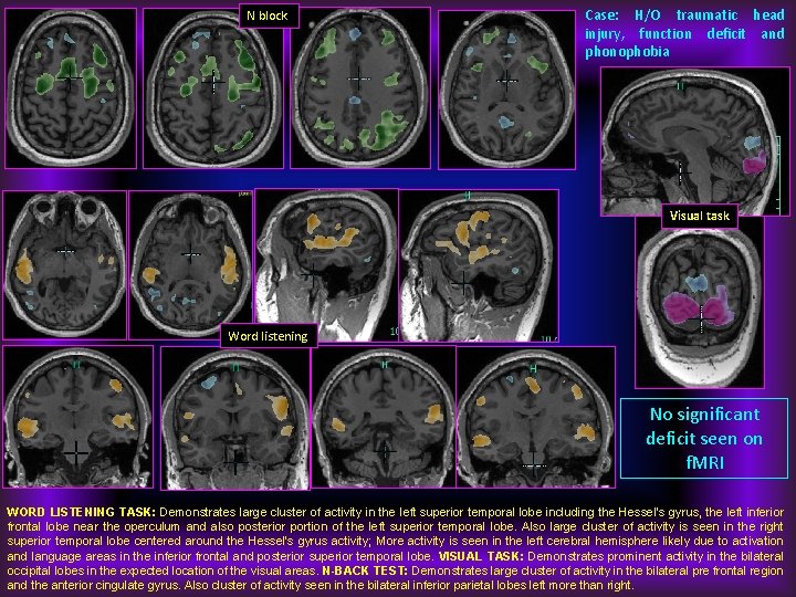 N block Case: H/O traumatic head injury, function deficit and phonophobia Visual task Word