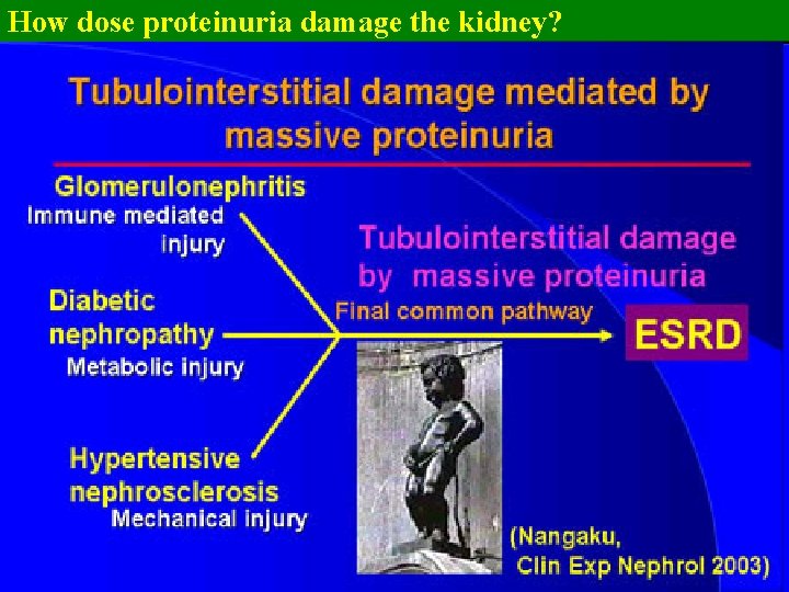 How dose proteinuria damage the kidney? 