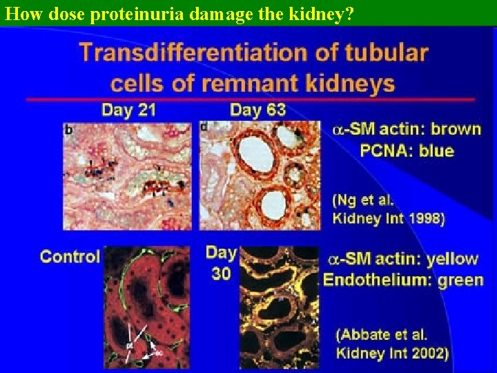 How dose proteinuria damage the kidney? 