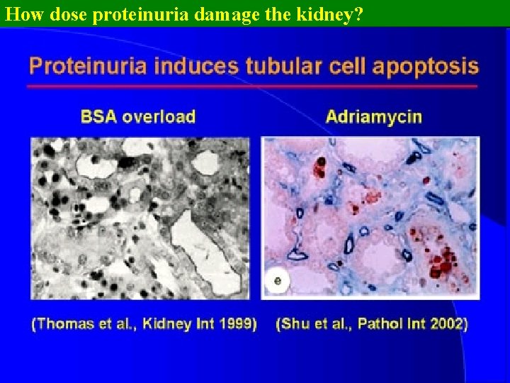 How dose proteinuria damage the kidney? 