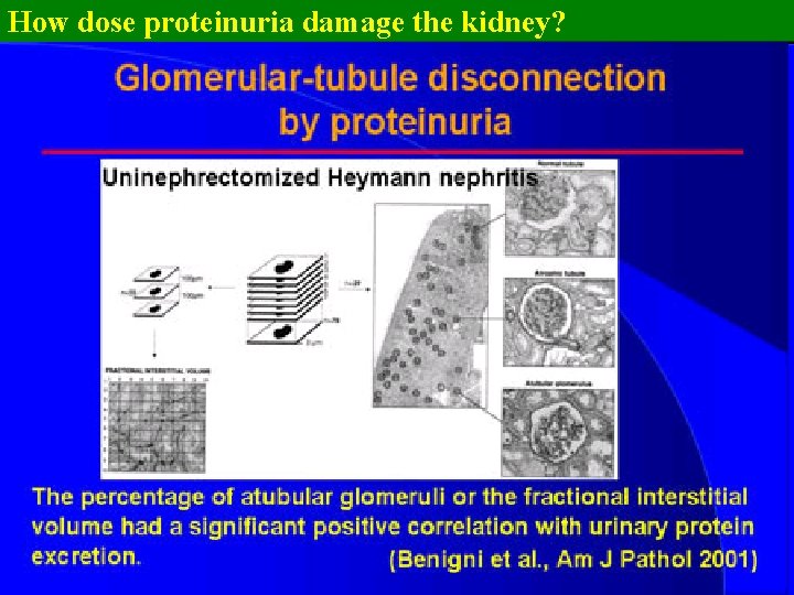 How dose proteinuria damage the kidney? 