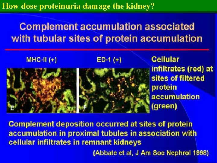 How dose proteinuria damage the kidney? 