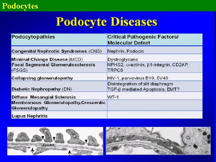 Podocytes 