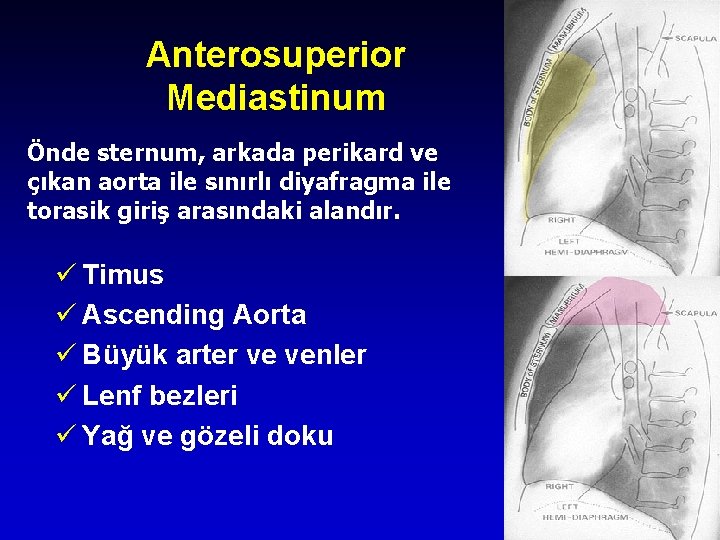 Anterosuperior Mediastinum Önde sternum, arkada perikard ve çıkan aorta ile sınırlı diyafragma ile torasik