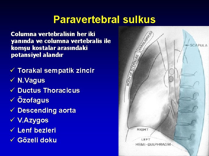 Paravertebral sulkus Columna vertebralisin her iki yanında ve columna vertebralis ile komşu kostalar arasındaki