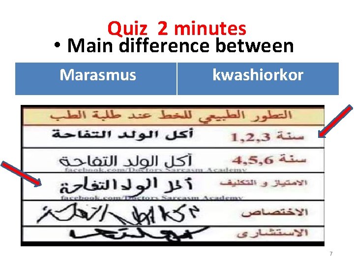 Quiz 2 minutes • Main difference between Marasmus kwashiorkor 7 