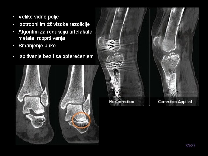  • Veliko vidno polje • Izotropni imidž visoke rezolicije • Algoritmi za redukciju