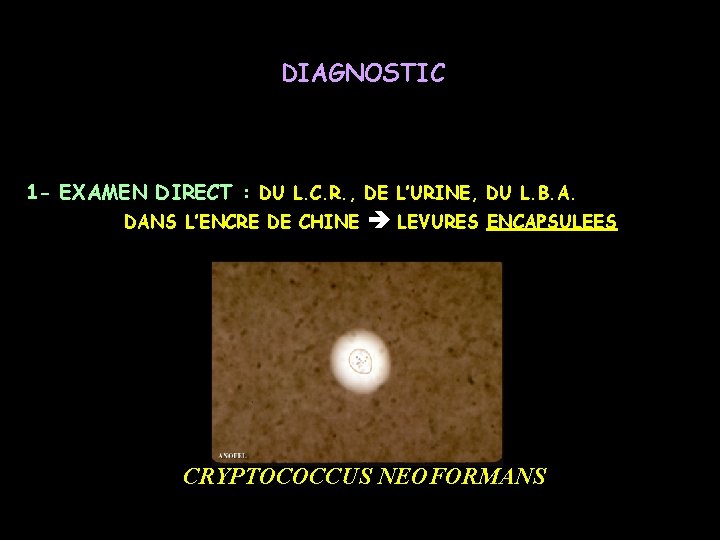 DIAGNOSTIC 1 - EXAMEN DIRECT : DU L. C. R. , DE L’URINE, DU