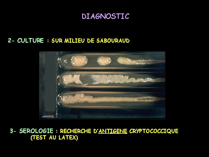 DIAGNOSTIC 2 - CULTURE : SUR MILIEU DE SABOURAUD 3 - SEROLOGIE : RECHERCHE