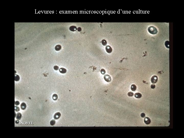 Levures : examen microscopique d’une culture 