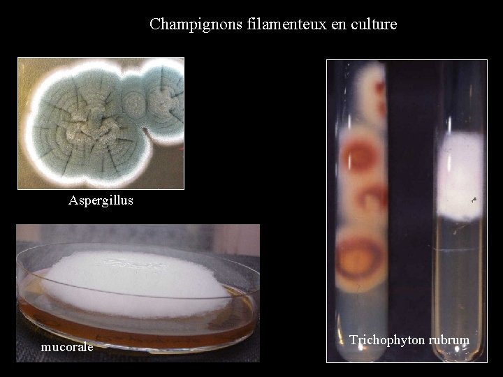 Champignons filamenteux en culture Aspergillus mucorale Trichophyton rubrum 