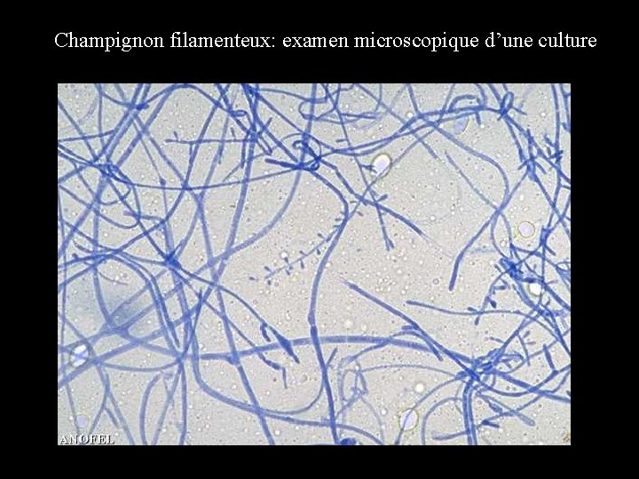 Champignon filamenteux: examen microscopique d’une culture 