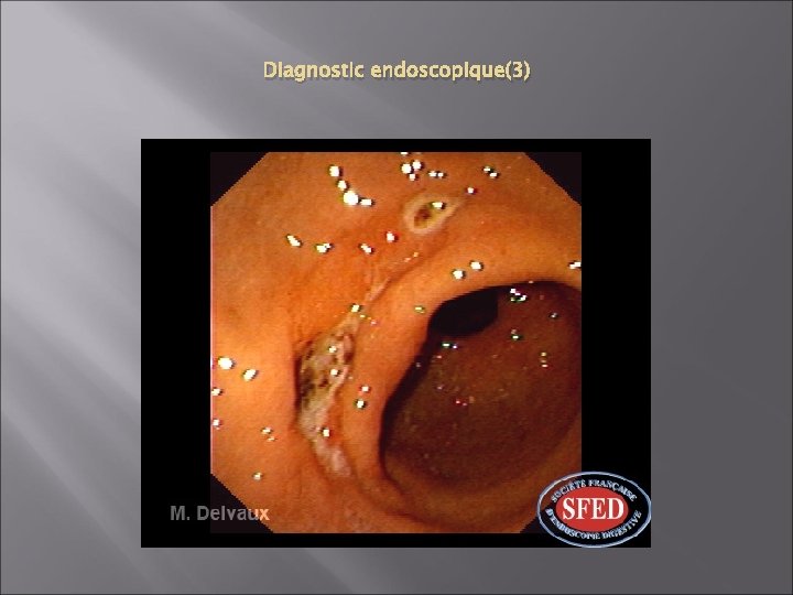 Diagnostic endoscopique(3) 