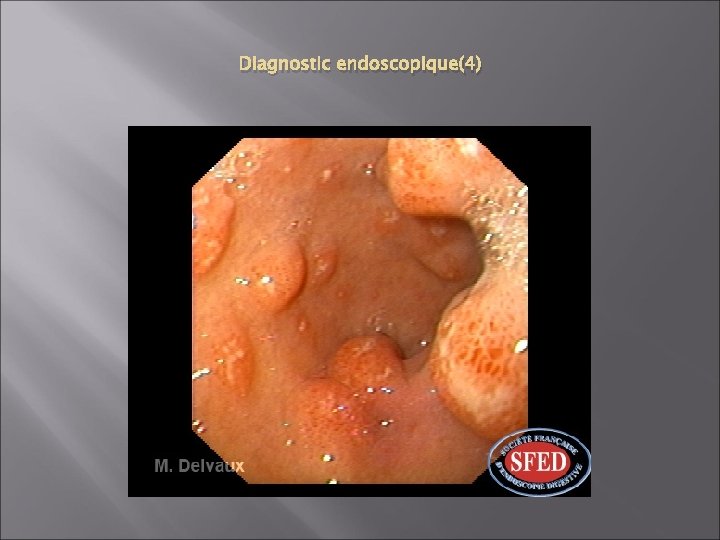 Diagnostic endoscopique(4) 
