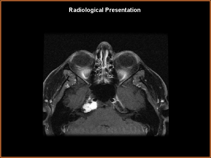 Radiological Presentation 