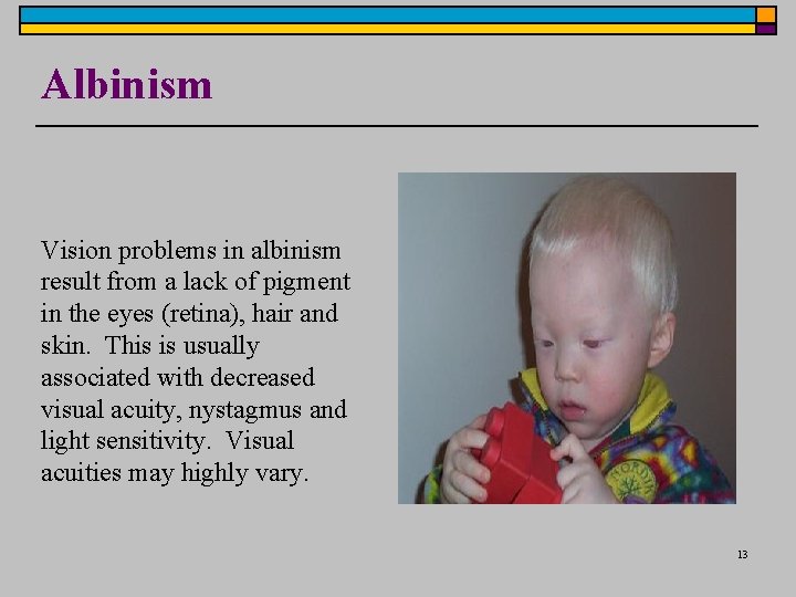 Albinism Vision problems in albinism result from a lack of pigment in the eyes Albinism Vision problems in albinism result from a lack of pigment in the eyes