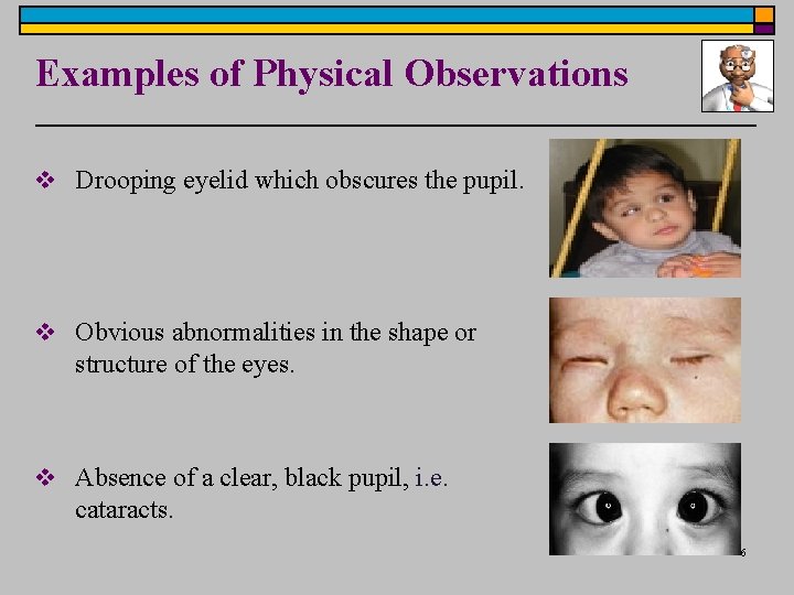 Examples of Physical Observations v Drooping eyelid which obscures the pupil. v Obvious abnormalities Examples of Physical Observations v Drooping eyelid which obscures the pupil. v Obvious abnormalities