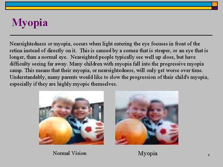 Myopia Nearsightedness or myopia, occurs when light entering the eye focuses in front of Myopia Nearsightedness or myopia, occurs when light entering the eye focuses in front of