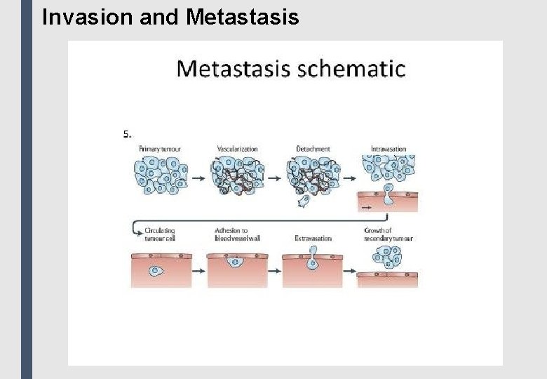 Invasion and Metastasis 