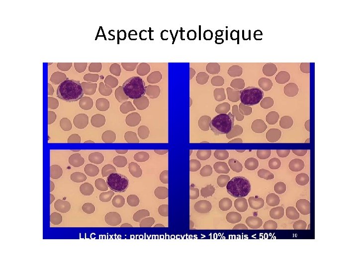 Aspect cytologique 