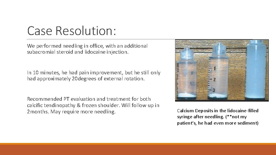 Case Resolution: We performed needling in office, with an additional subacromial steroid and lidocaine