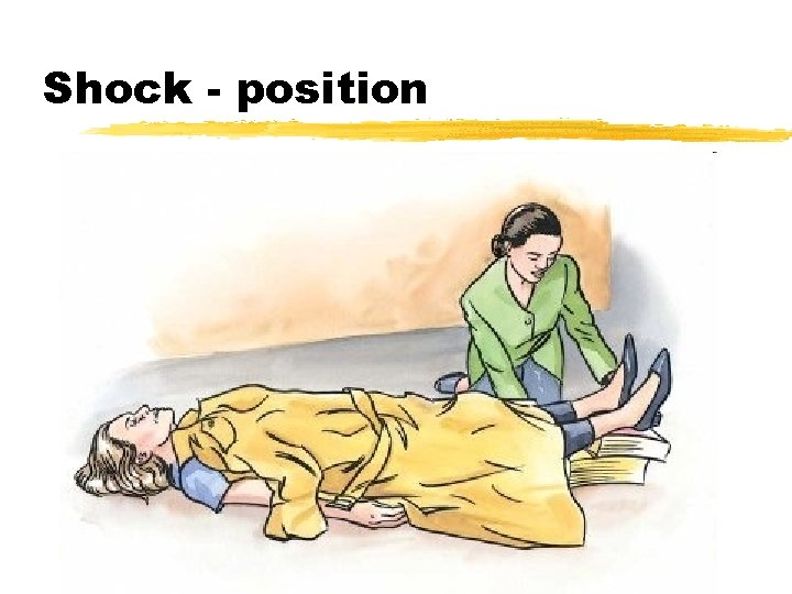 Shock - position 