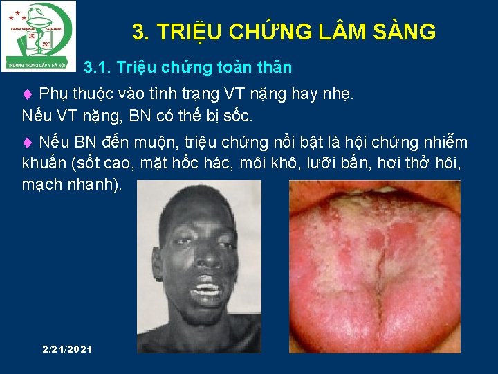 3. TRIỆU CHỨNG L M SÀNG 3. 1. Triệu chứng toàn thân Phụ thuộc